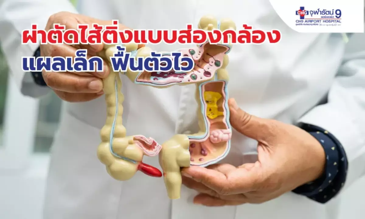 ผ่าตัดไส้ติ่งมีกี่แบบ พักฟื้นกี่วัน กินอะไรได้บ้าง
